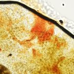 Superficial Skin Microscopy