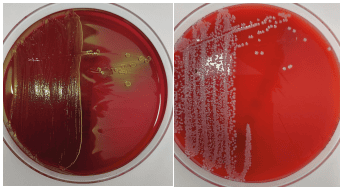 Photo of common cystitis pathogen Escherichia coli on endo agar and Staphylococcus pseudintermedius on sheep's blood agar 